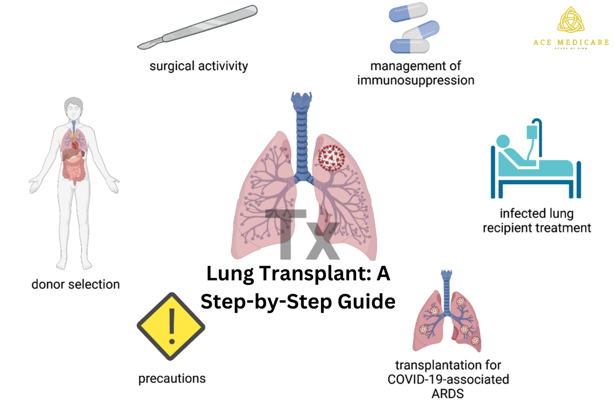Lung Transplant: A Step-by-Step Guide
